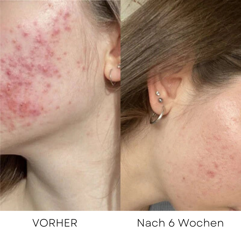 LumoGlow® - Tiefenreinigung für strahlend reine Haut