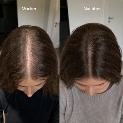 Lumo Haaröl® - Dein Haarwunder für sichtbar volleres & dichteres Haar